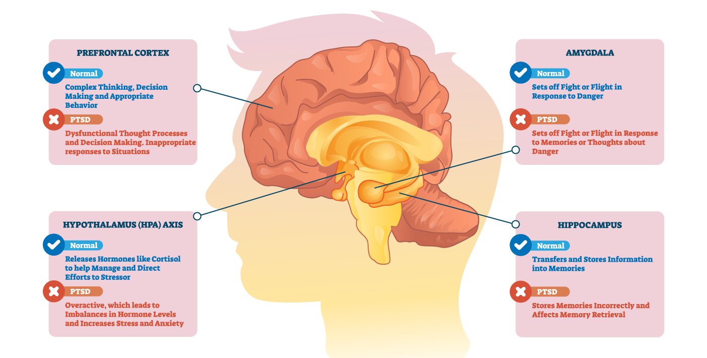 The areas of the brain that Therapeutic Parenting can help rewire.